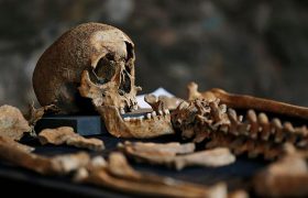 آزمایش دندان فسیل‌شده در گورستان پرده از منشأ طاعون سیاه اروپا برداشت